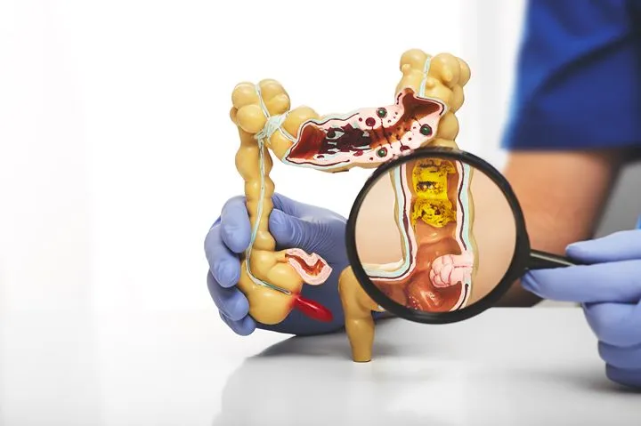 Medical model of the colon and digestive tract